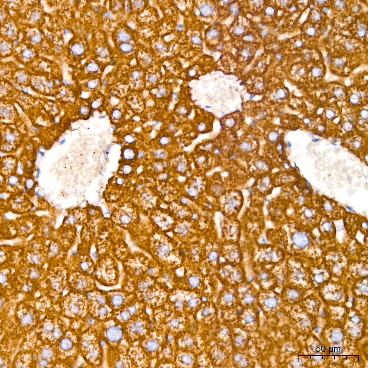 PBR Antibody (4I9K6)