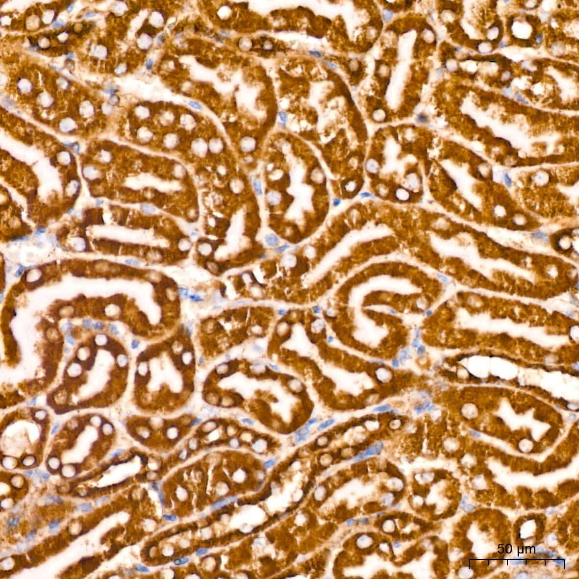 PBR Antibody (4I9K6)