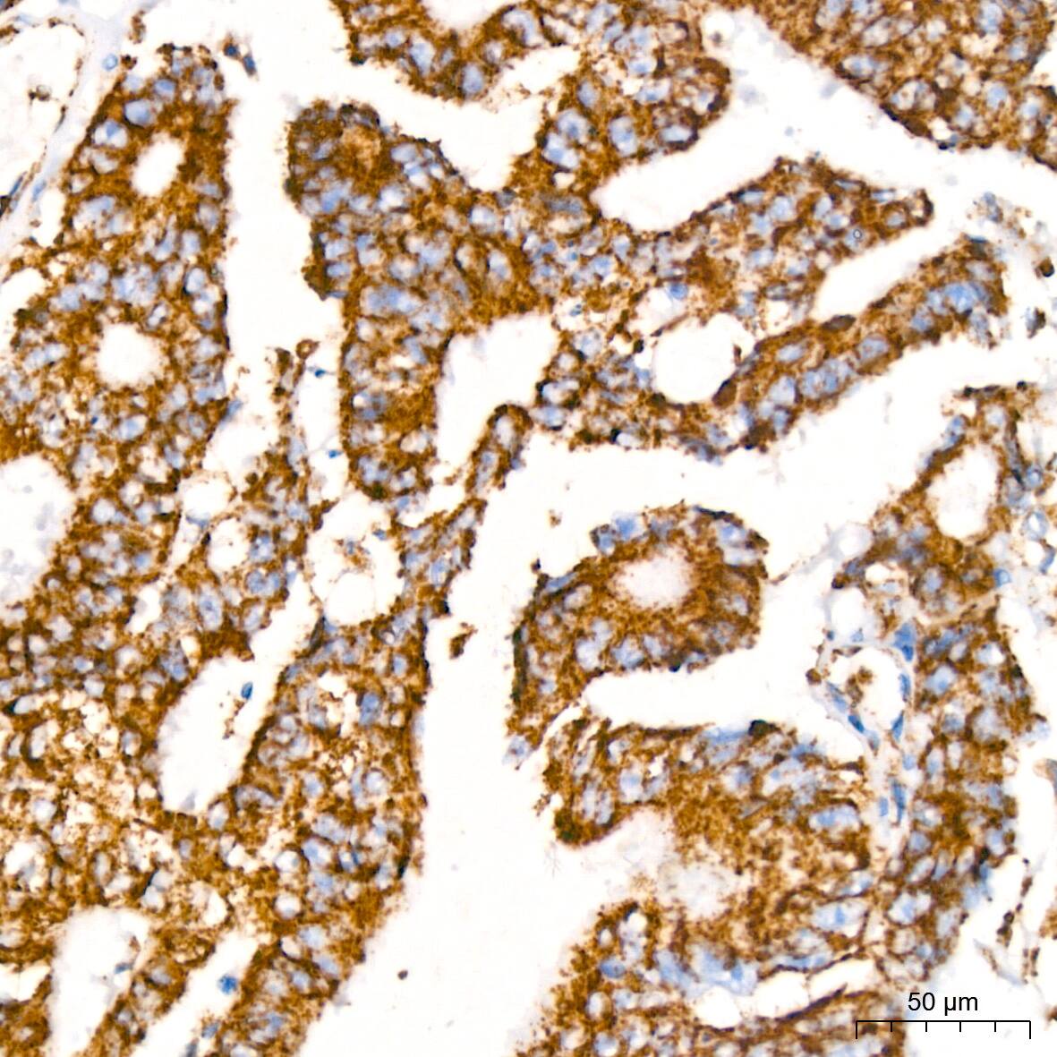 PBR Antibody (4I9K6)