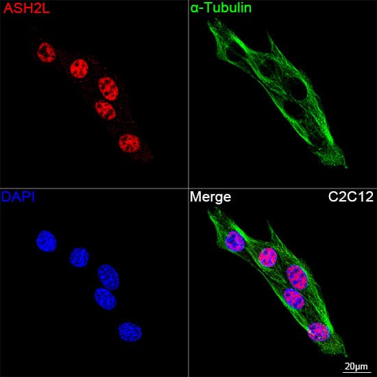 ASH2L Antibody (10B6U5)