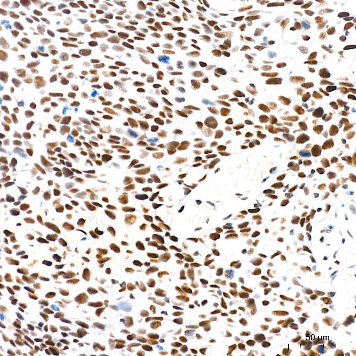 ASH2L Antibody (10B6U5)