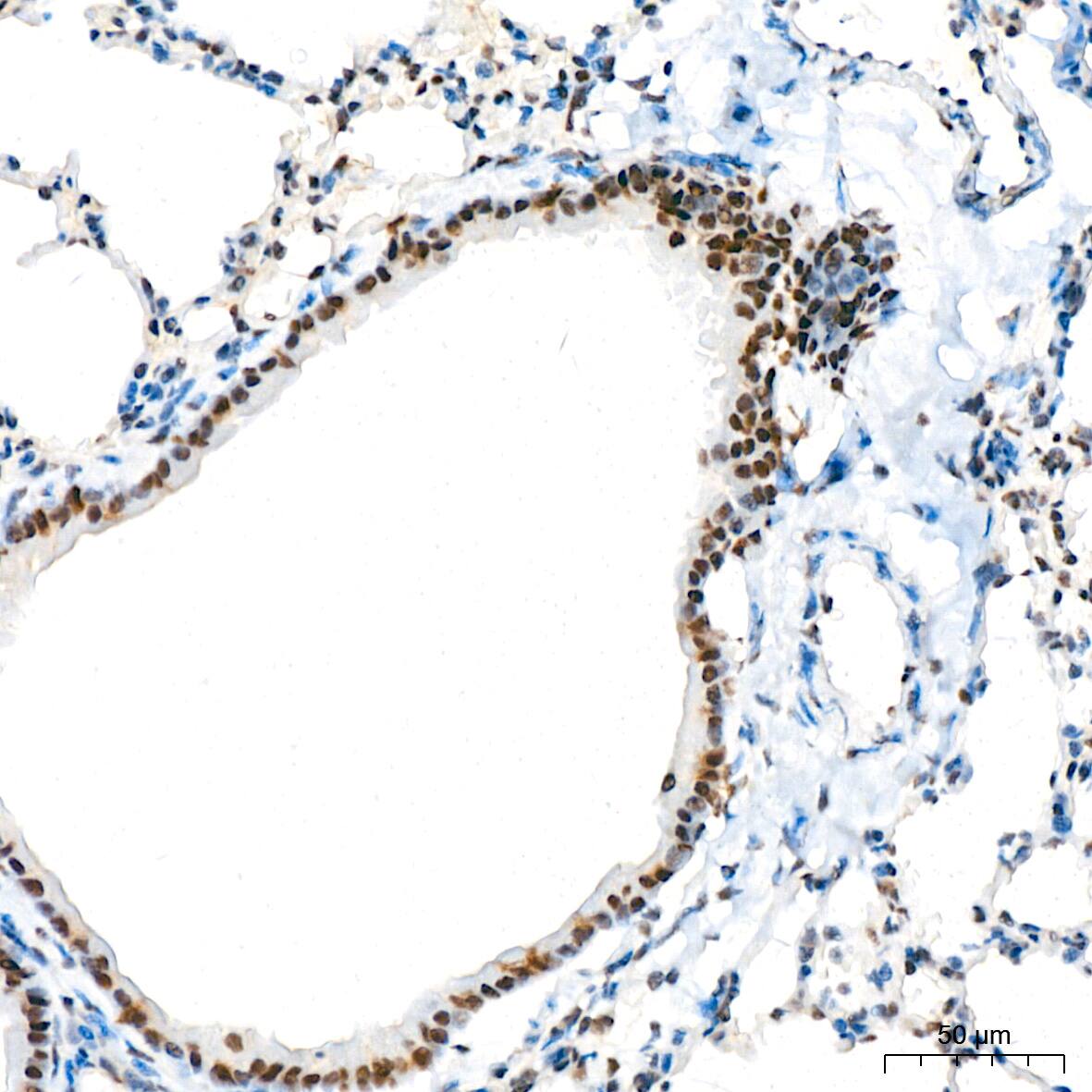 ASH2L Antibody (10B6U5)