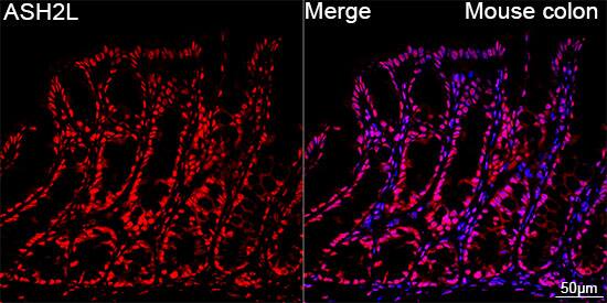 ASH2L Antibody (10B6U5)