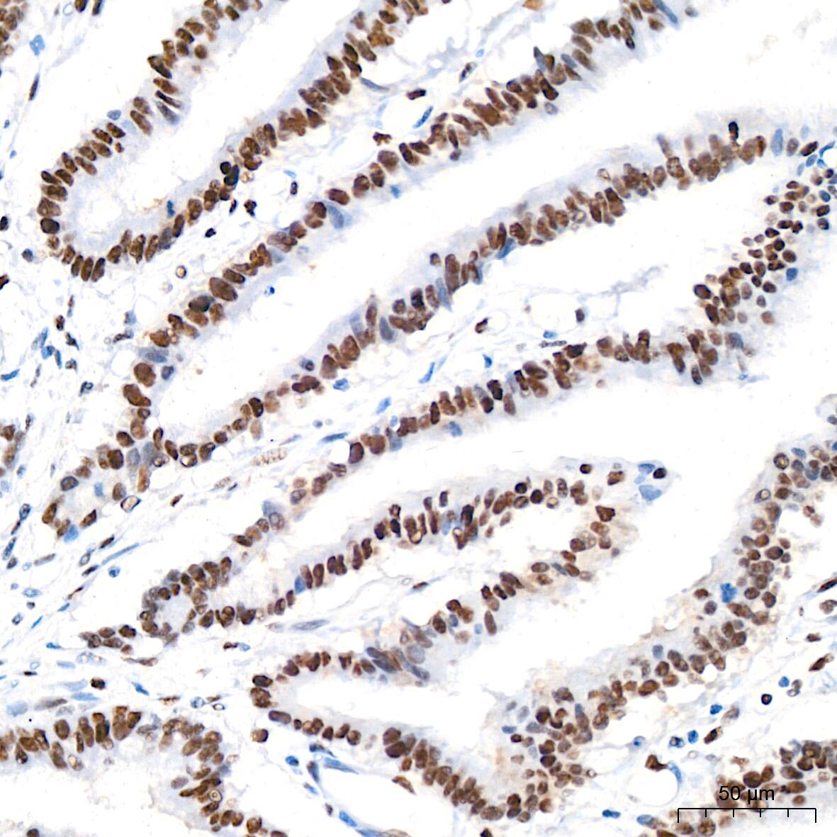 ASH2L Antibody (10B6U5)