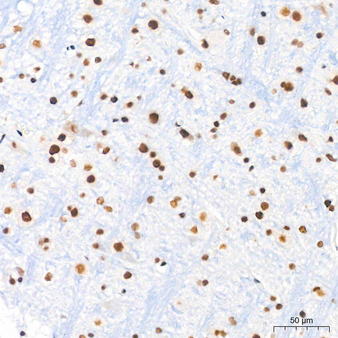 ASH2L Antibody (10B6U5)