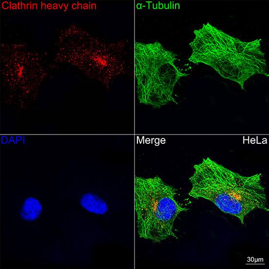 Clathrin Heavy Chain 1/CHC17 Antibody (9M2G2)