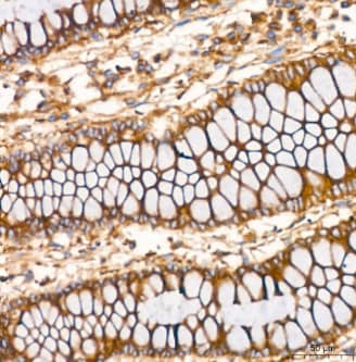 Clathrin Heavy Chain 1/CHC17 Antibody (9M2G2)