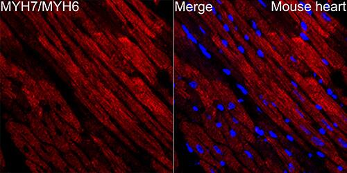 MYH6/7 Antibody (6V0G1)