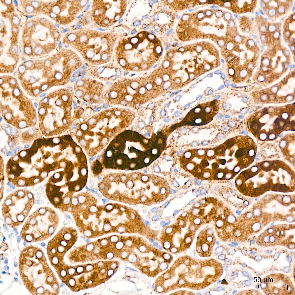 Cathepsin L/V/K/H Antibody (2Q10F10)