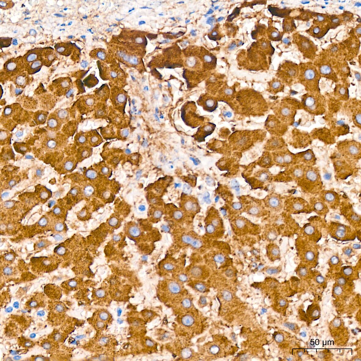 Cathepsin L/V/K/H Antibody (2Q10F10)