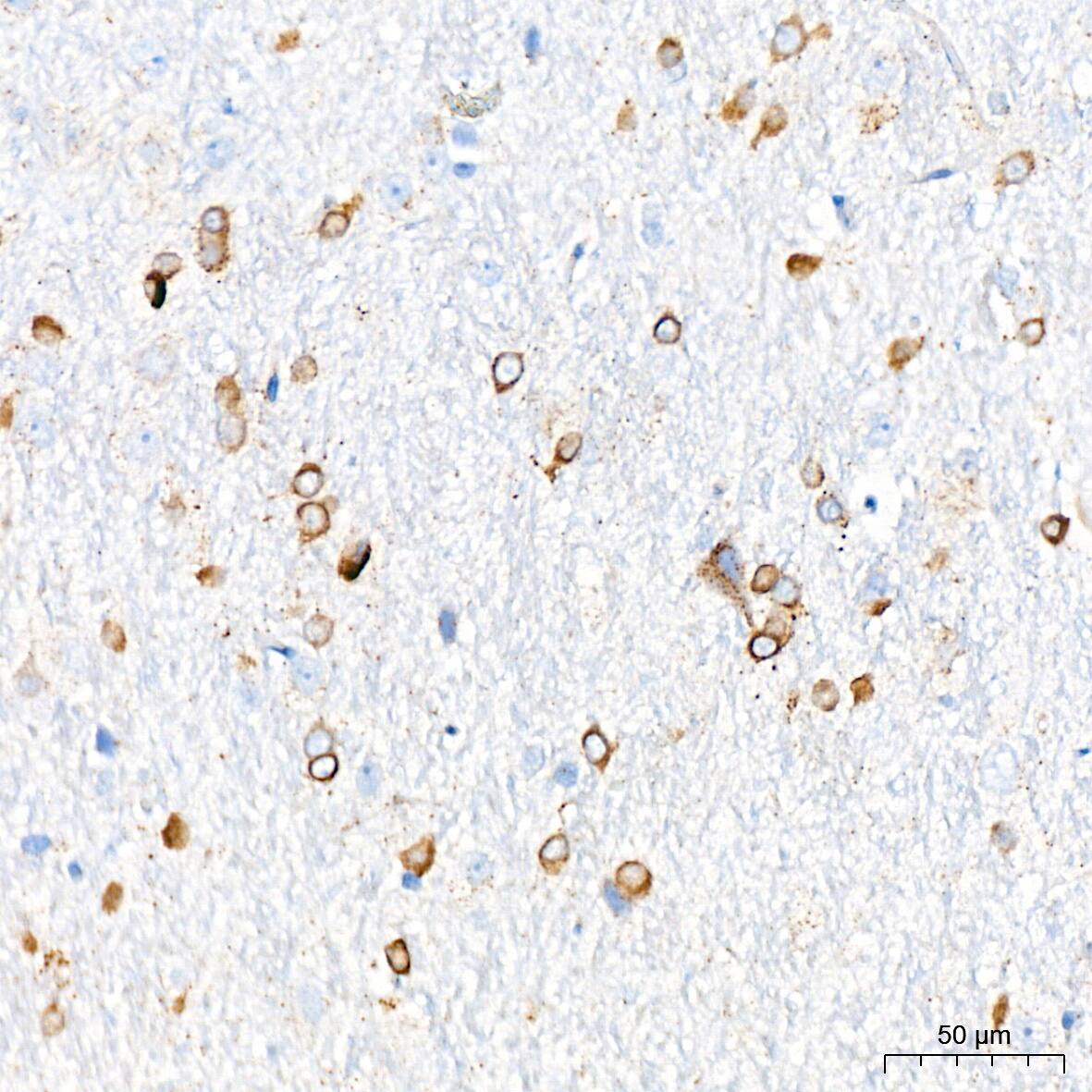 Cathepsin L/V/K/H Antibody (2Q10F10)