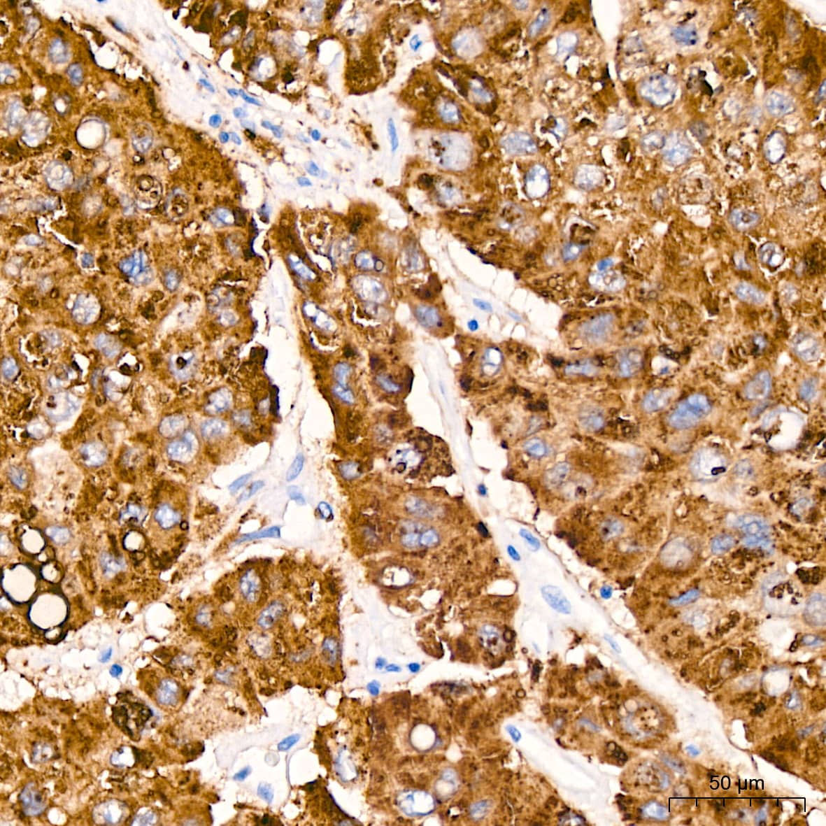Cathepsin L/V/K/H Antibody (2Q10F10)