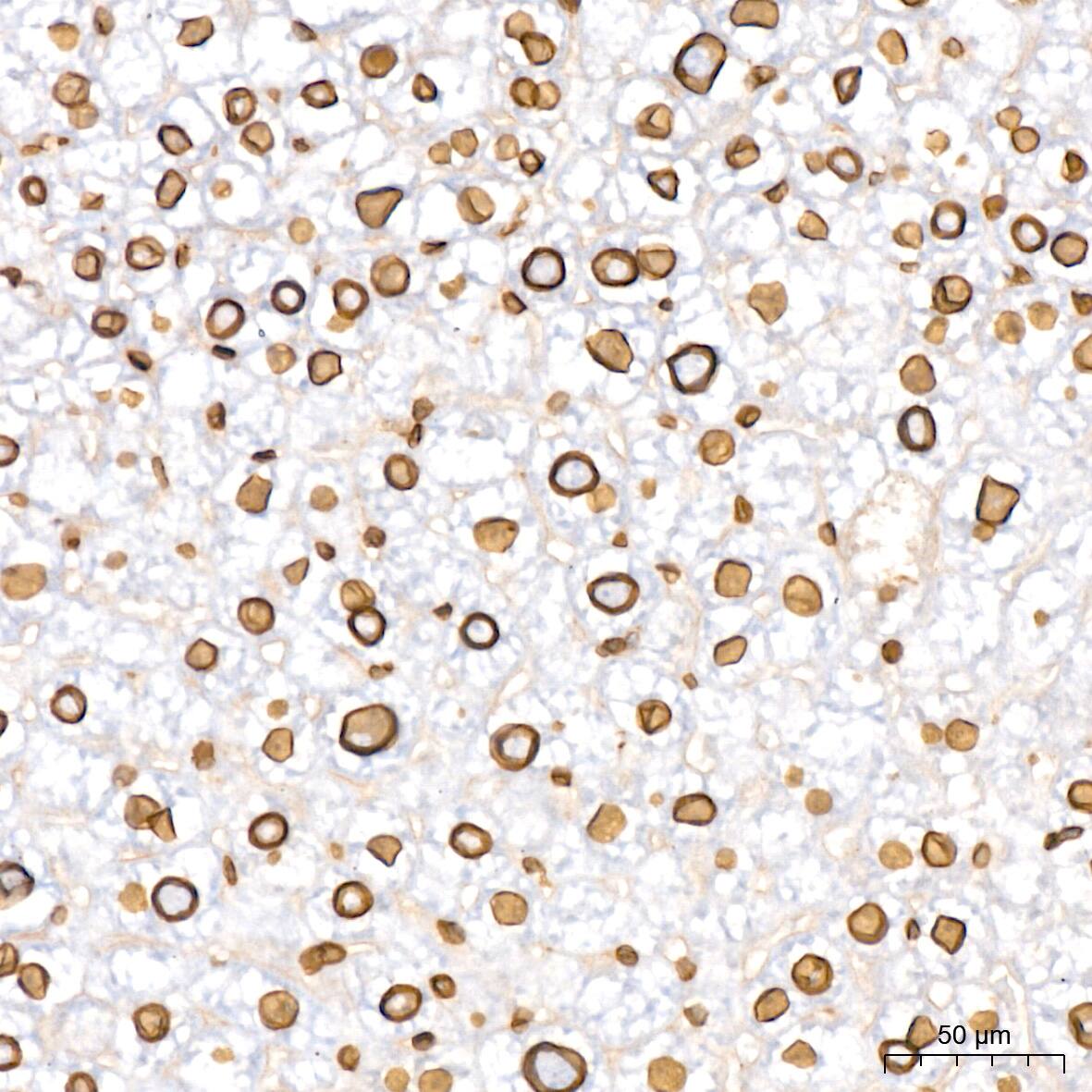 Lamin B2 Antibody (1S9M6)