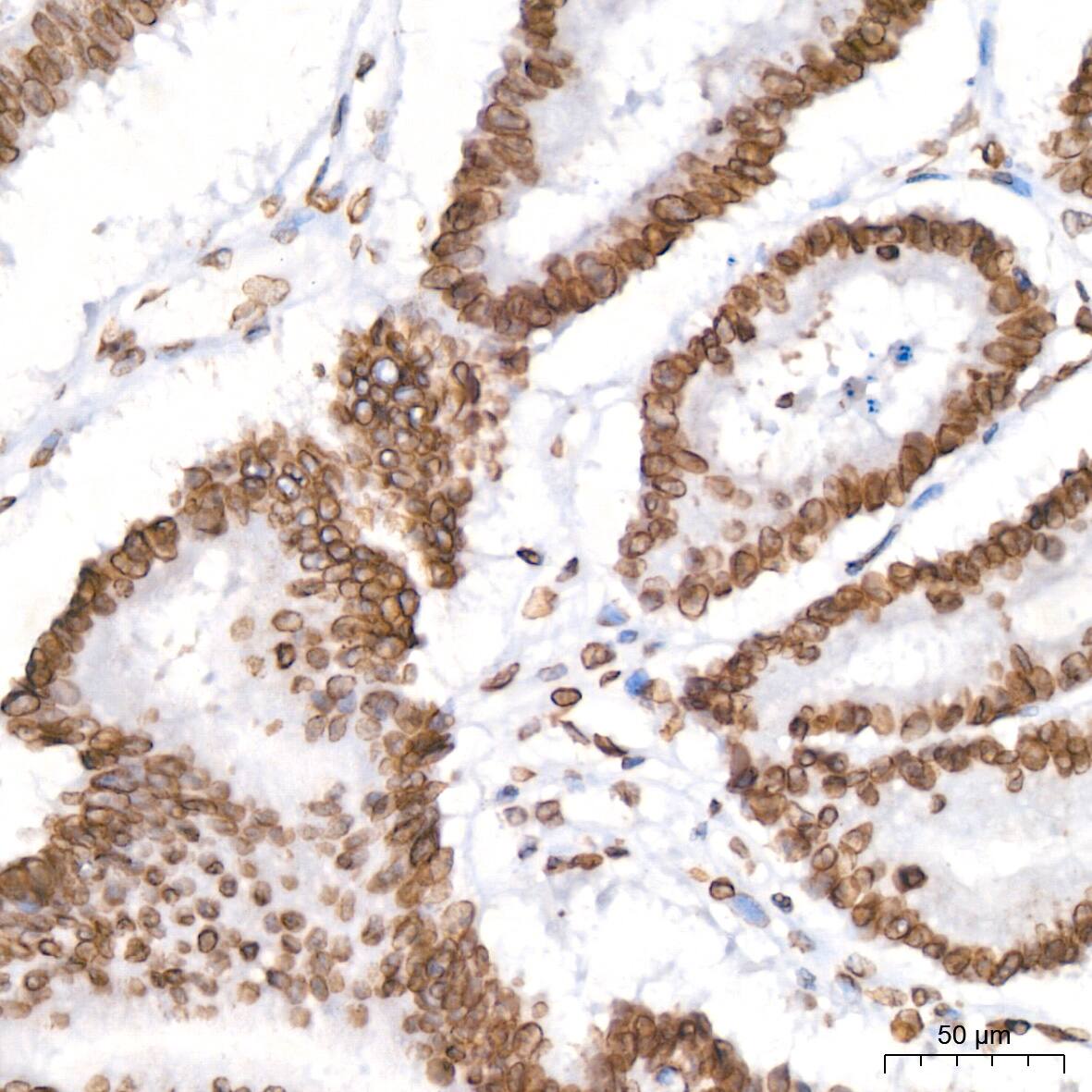 Lamin B2 Antibody (1S9M6)