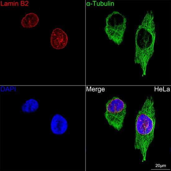 Lamin B2 Antibody (1S9M6)