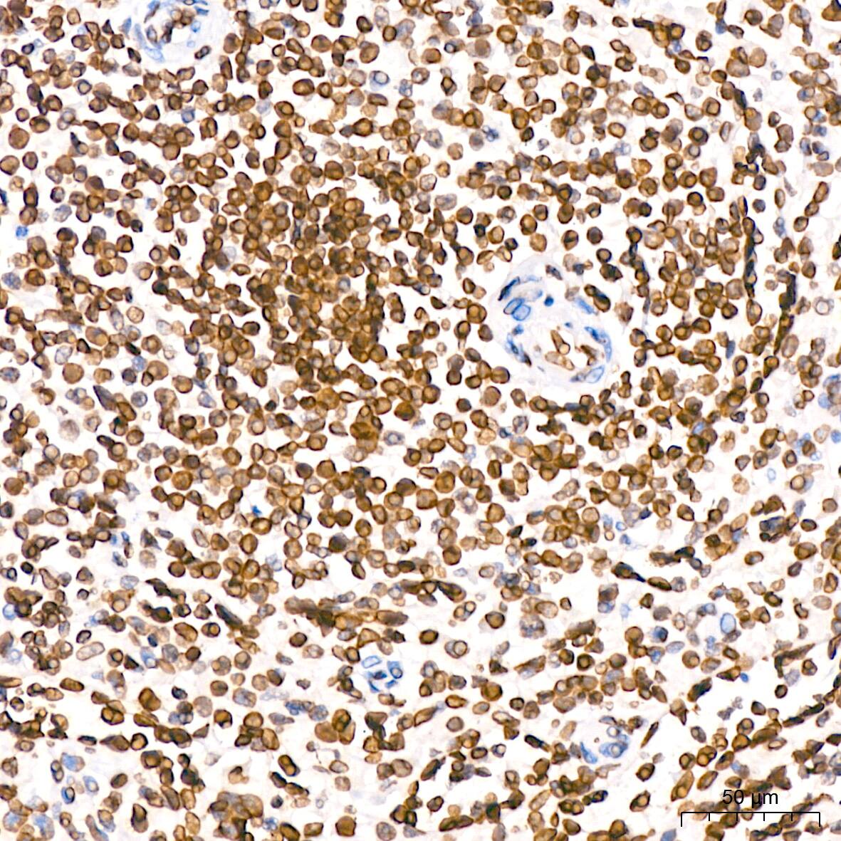 Lamin B2 Antibody (1S9M6)