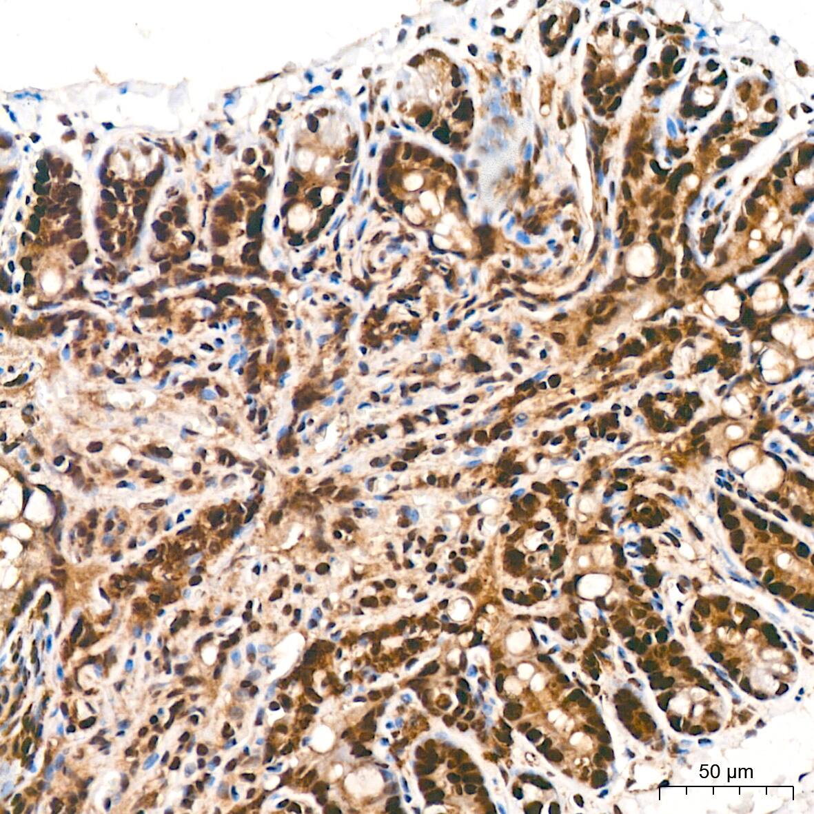 DDB1 Antibody (9L8X5)