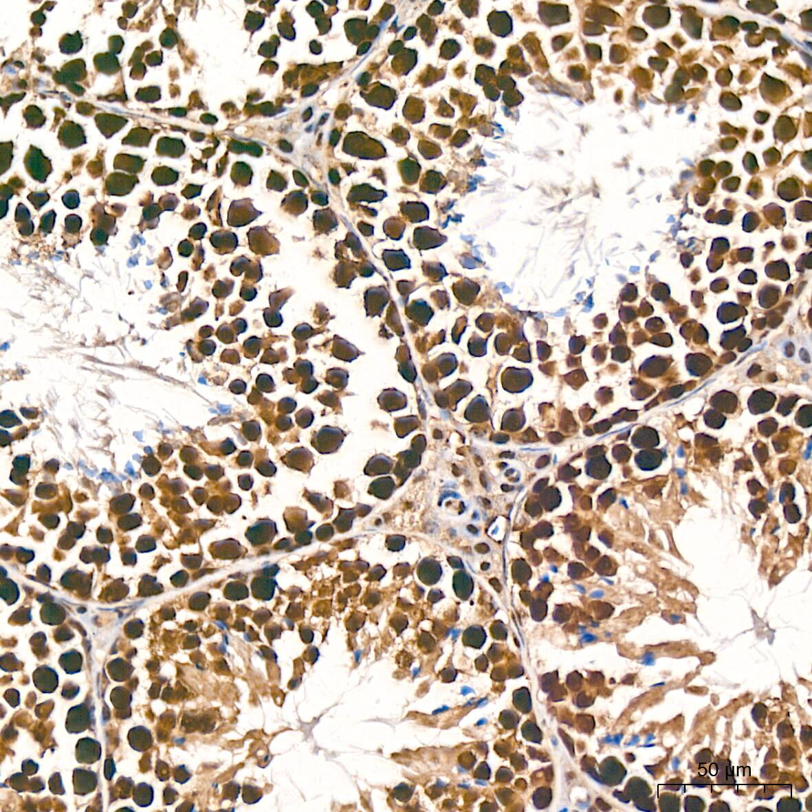 DDB1 Antibody (9L8X5)