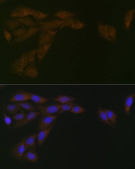 POR/Cytochrome P450 Reductase Antibody (9U1U7)