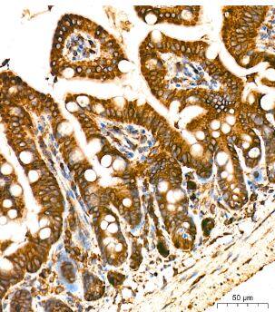 POR/Cytochrome P450 Reductase Antibody (9U1U7)