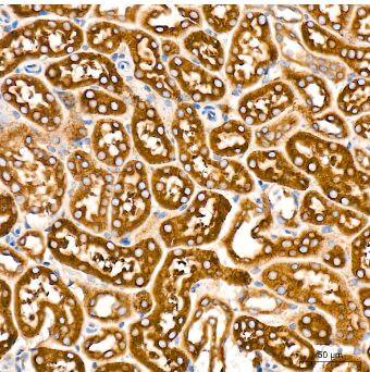 POR/Cytochrome P450 Reductase Antibody (9U1U7)