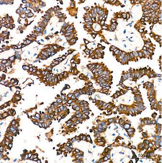 POR/Cytochrome P450 Reductase Antibody (9U1U7)