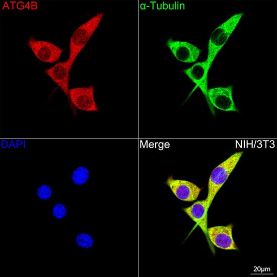 ATG4B Antibody (9H6M6)
