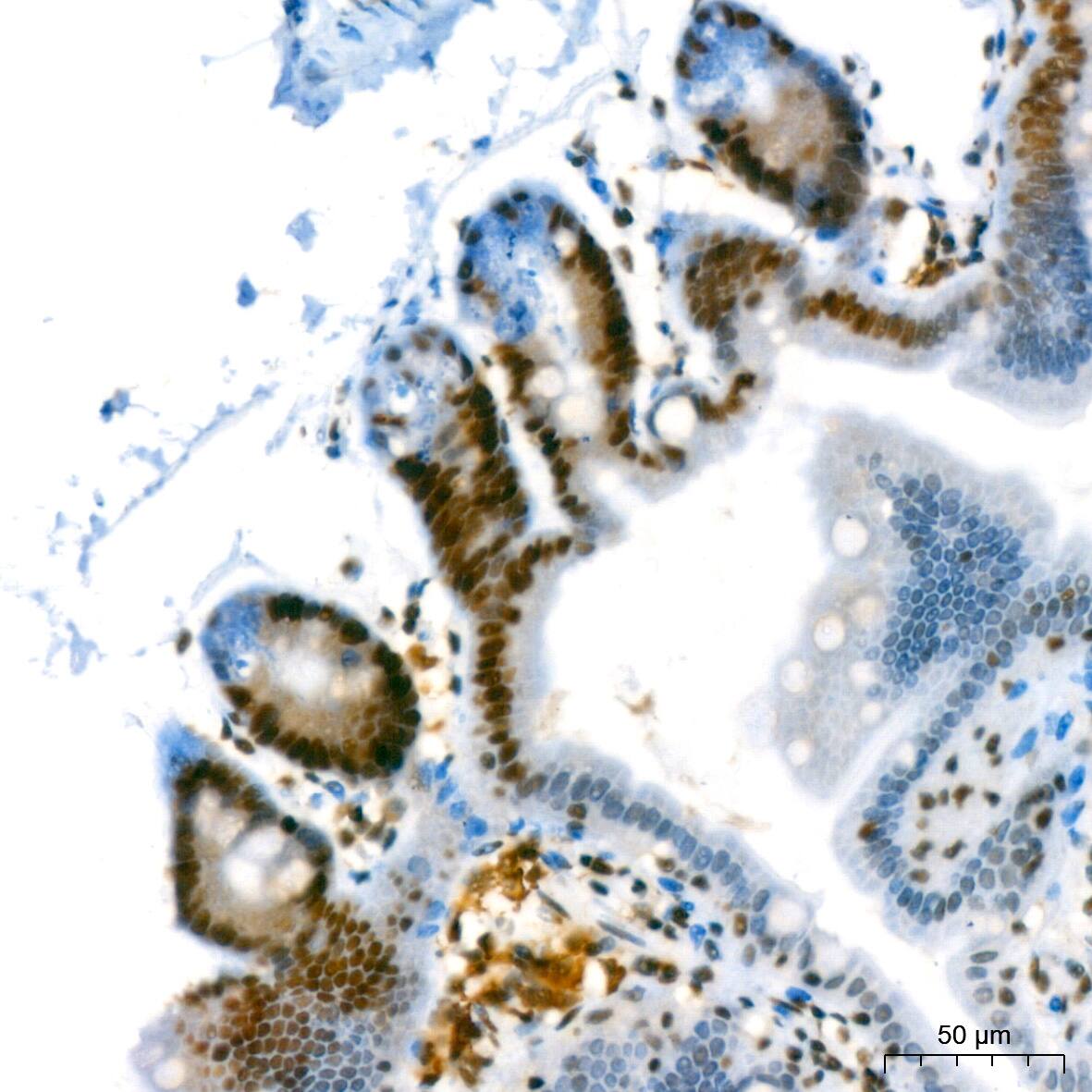 SUMO2/3 Antibody (6R8G7)