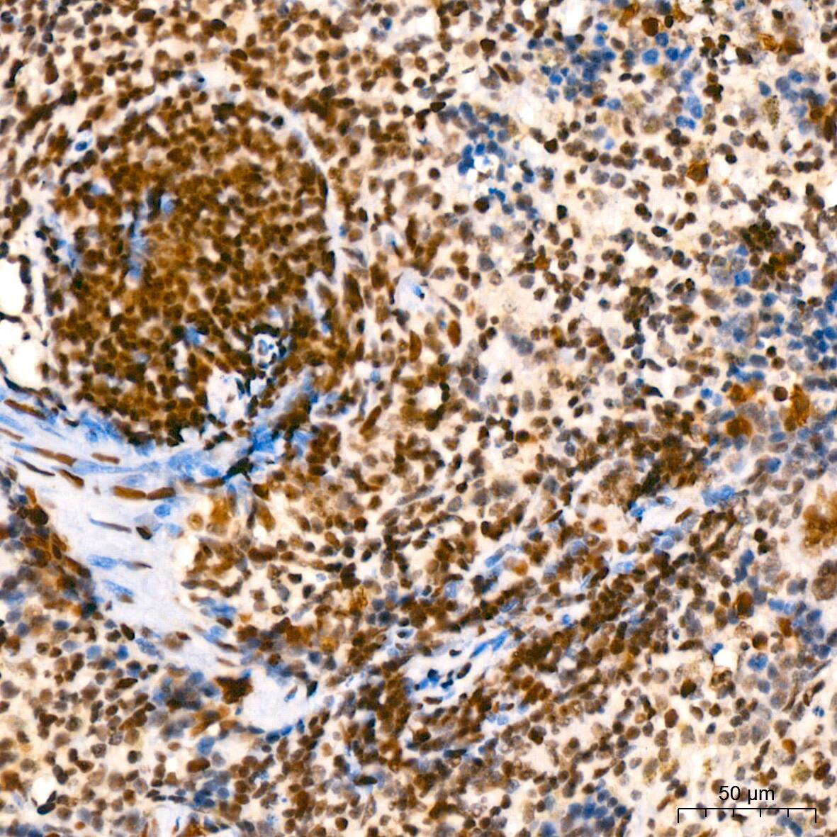 SUMO2/3 Antibody (6R8G7)