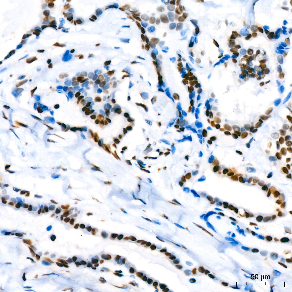 SUMO2/3 Antibody (6R8G7)
