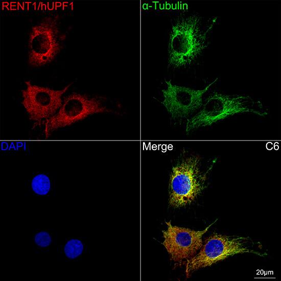 RENT1/UPF1/hUPF1 Antibody (5D5C4)