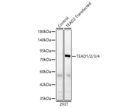 TEAD (pan) Antibody (3Q10Q8)