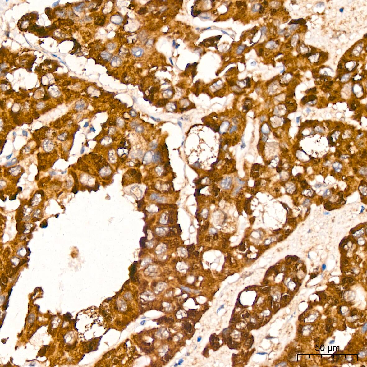 Proteasome 20S alpha 3 Antibody (7X8W9)