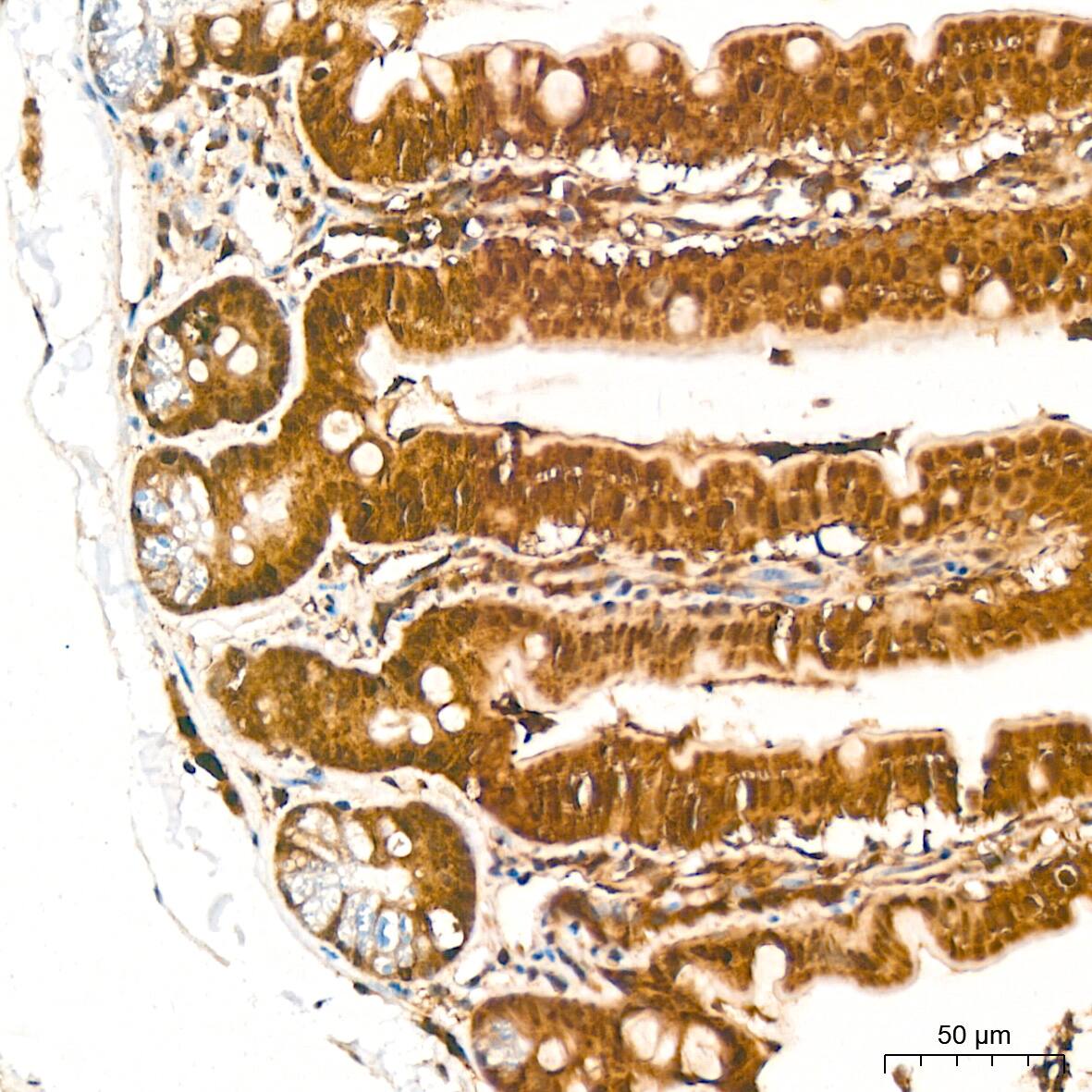Proteasome 20S alpha 3 Antibody (7X8W9)