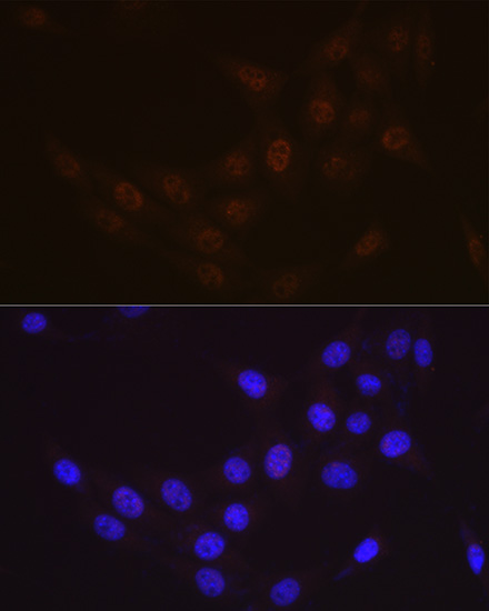 Rad23 Antibody (3B7T9)