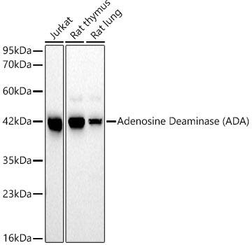 Adenosine Deaminase/ADA Antibody (5R10B4)