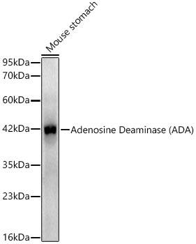 Adenosine Deaminase/ADA Antibody (5R10B4)