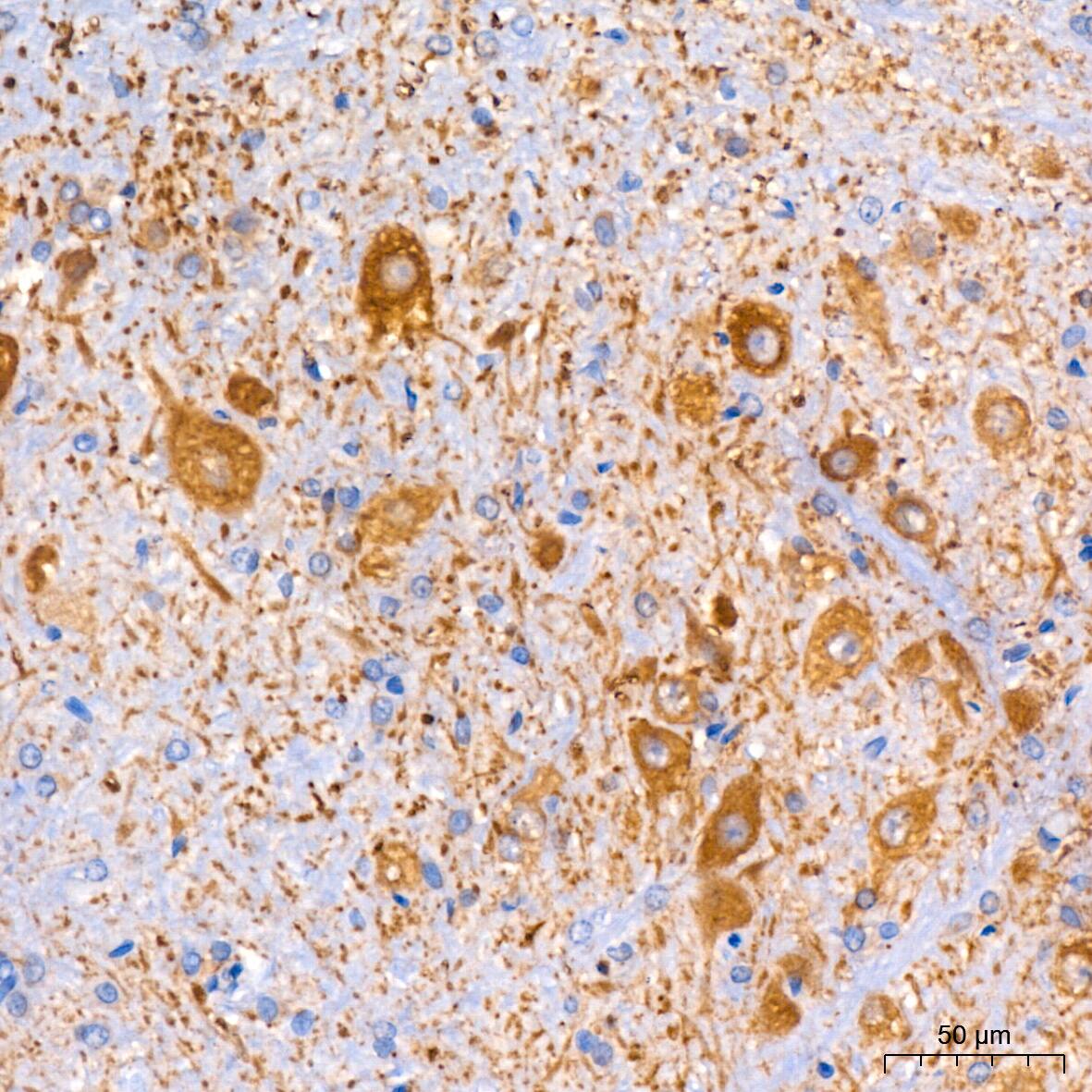 Muscarinic Acetylcholine Receptor M2/CHRM2 Antibody (3T5W8)