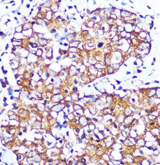 Muscarinic Acetylcholine Receptor M2/CHRM2 Antibody (3T5W8)