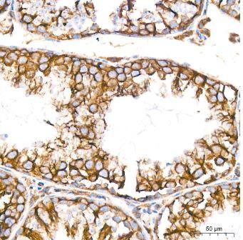 Muscarinic Acetylcholine Receptor M2/CHRM2 Antibody (3T5W8)