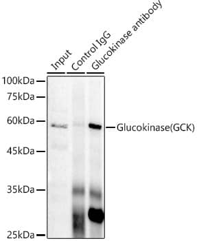 Glucokinase/GCK Antibody (4K9D5)