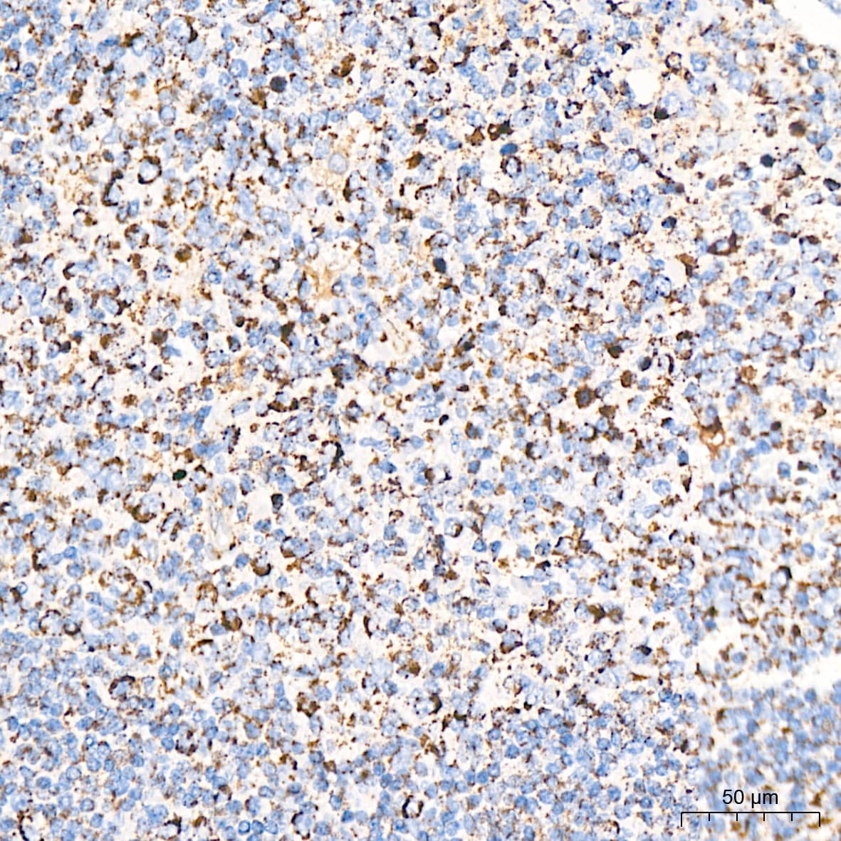 Dihydrolipoamide Dehydrogenase/DLD Antibody (3J2O9)