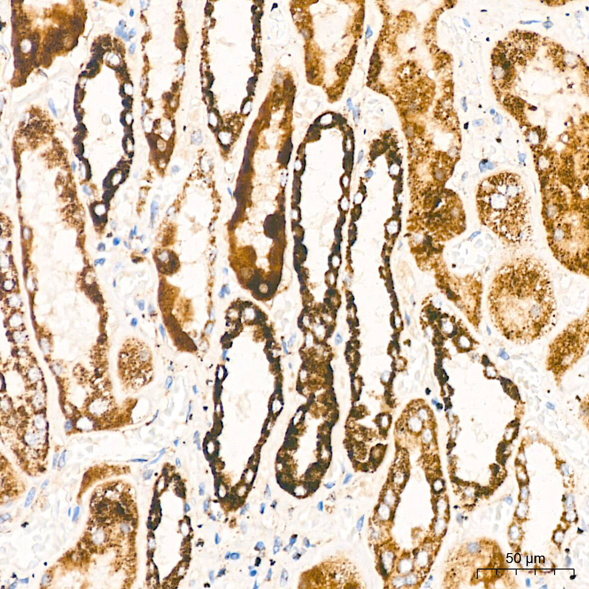 Dihydrolipoamide Dehydrogenase/DLD Antibody (3J2O9)