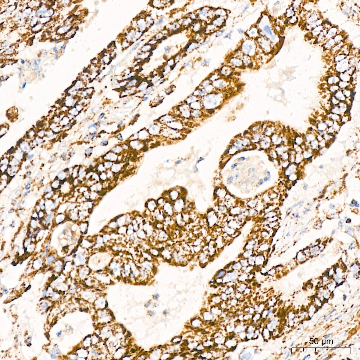 Dihydrolipoamide Dehydrogenase/DLD Antibody (3J2O9)
