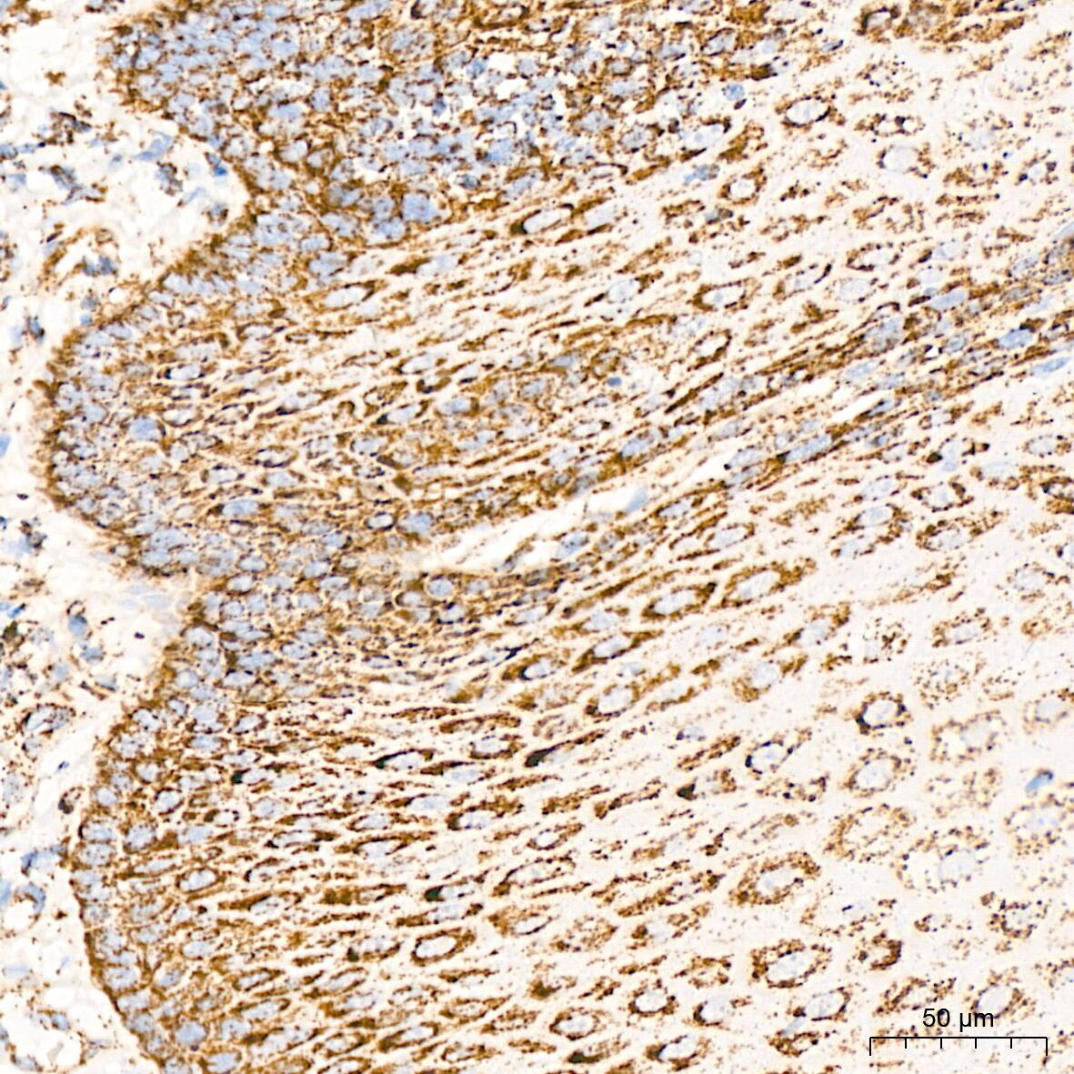 Dihydrolipoamide Dehydrogenase/DLD Antibody (3J2O9)