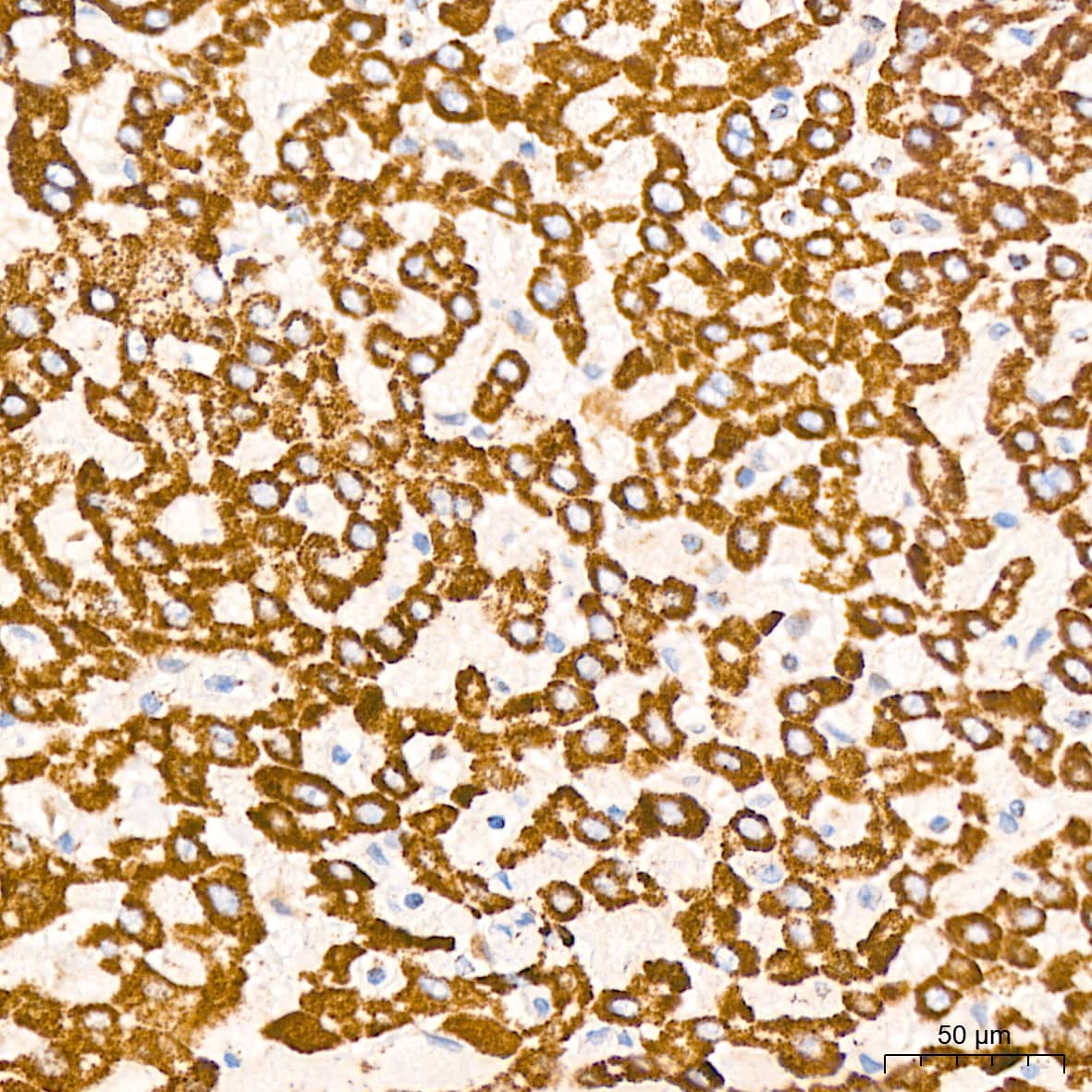 Dihydrolipoamide Dehydrogenase/DLD Antibody (3J2O9)