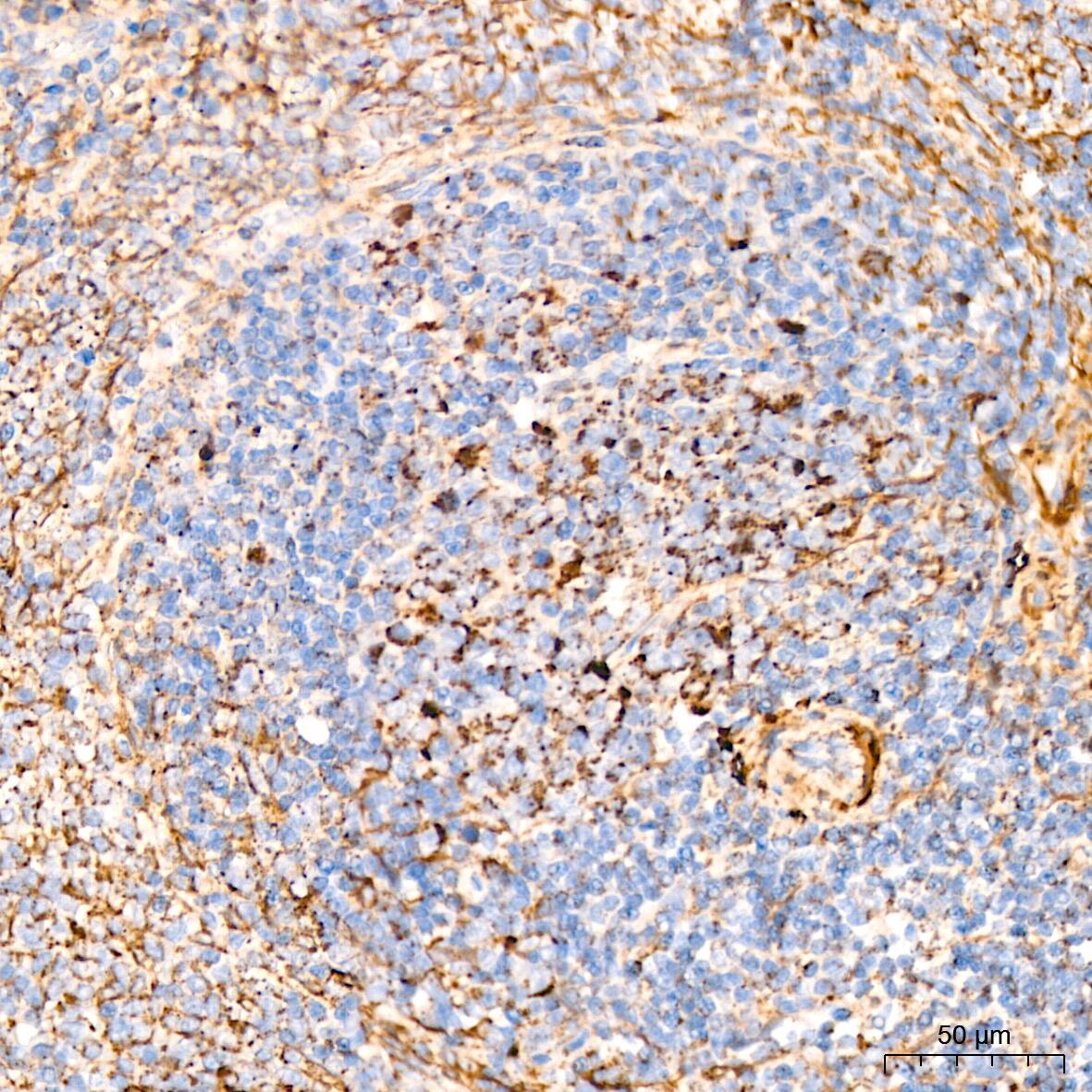 Dihydrolipoamide Dehydrogenase/DLD Antibody (3J2O9)