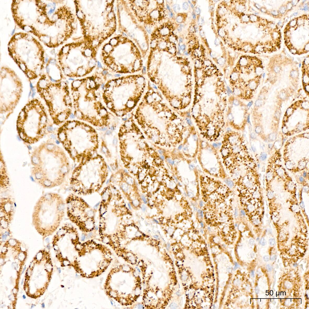 Dihydrolipoamide Dehydrogenase/DLD Antibody (3J2O9)