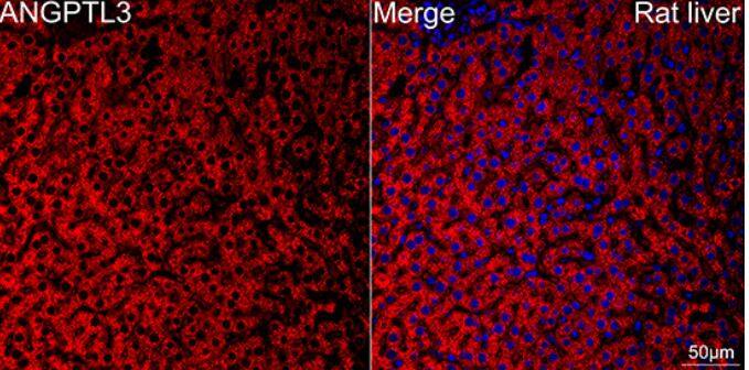 Angiopoietin-like Protein 3/ANGPTL3 Antibody (4W9A7)