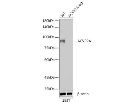 Activin RIIA Antibody (1K1J10)